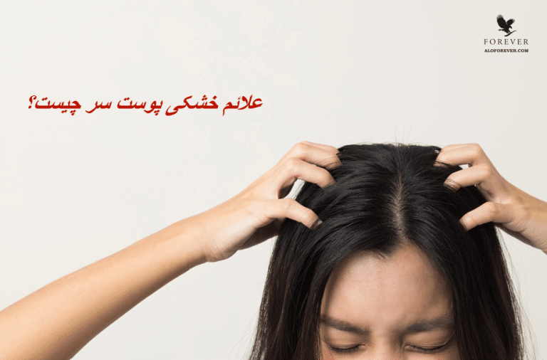 علائم خشکی پوست سر چیست؟