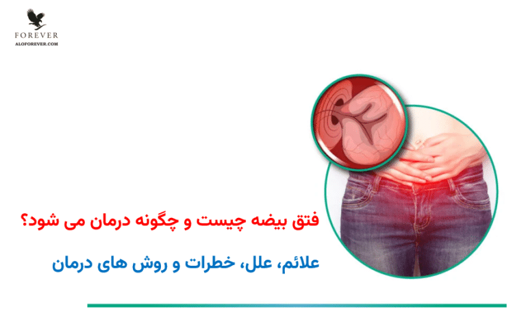 فتق بیضه چیست و چگونه درمان می‌شود؟